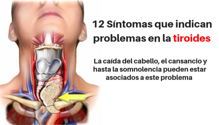 12 síntomas que ayudan a detectar problemas en la glándula tiroides
