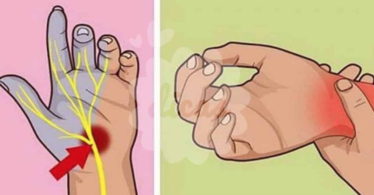 Síndrome Del Túnel Carpiano Sepa Lo Que Es Y Cómo Tratarlo