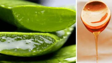 aloe vera y miel