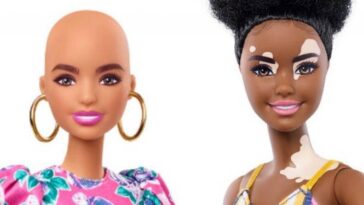 Barbie saca al mercado un modelo de muñeca con vitiligo y otra sin cabello