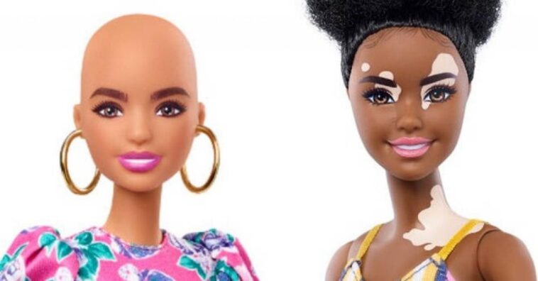 Barbie saca al mercado un modelo de muñeca con vitiligo y otra sin cabello
