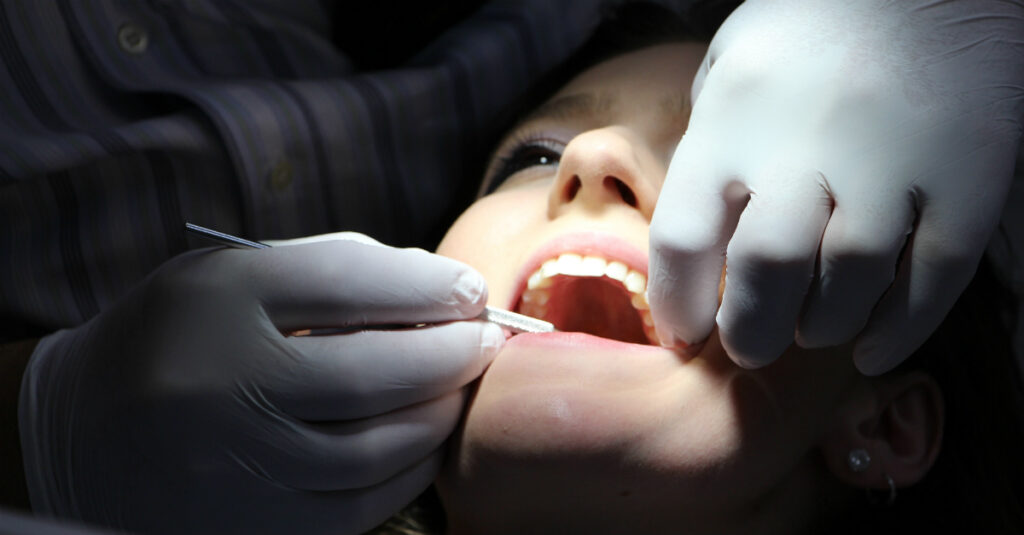 Causas del dolor de muelas que no significan tener caries