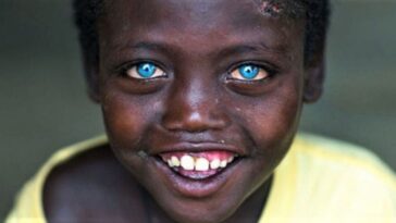 Critican y discriminan a un niño de 8 años por el color azul de sus ojos