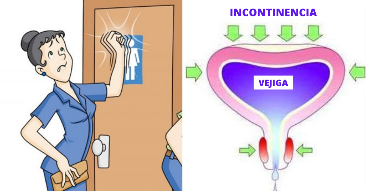 Incontinencia urinaria conoce qué es y cómo tratarla