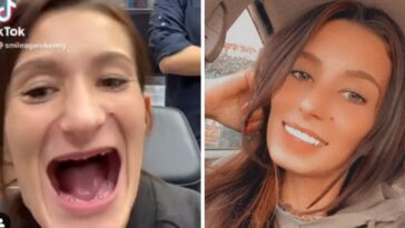 Mujer que perdió todos sus dientes se vuelve viral con una nueva sonrisa