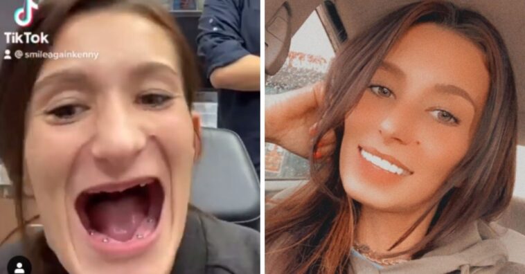 Mujer que perdió todos sus dientes se vuelve viral con una nueva sonrisa