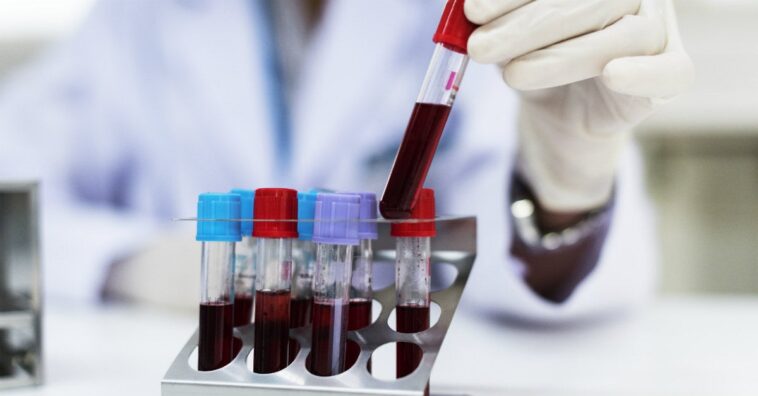 tipo de sangre puede aumentar el riesgo de trombosis y embolia