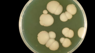 candida auris