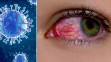 ojos rojos: un síntoma del coronavirus