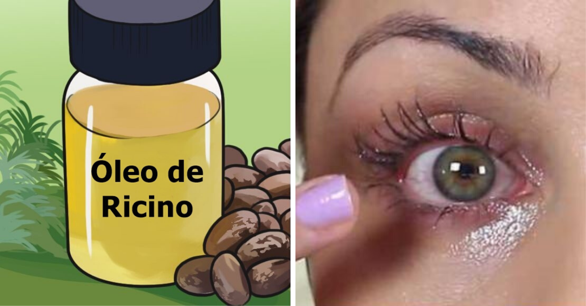 Aceite de ricino para los ojos: beneficios, cuidados y contraindicaciones