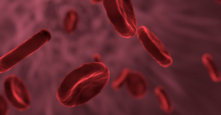 tipo de sangre puede estar relacionado con el riesgo de padecer embolia o trombosis