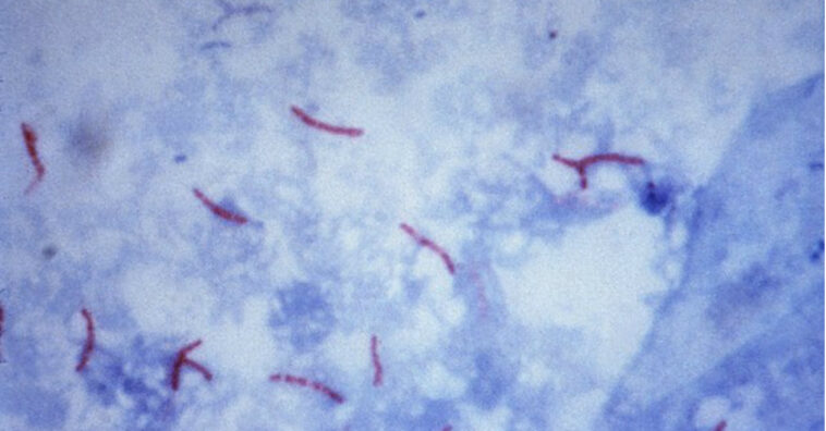 tuberculosis ocasionó 1,5 millones de fallecidos